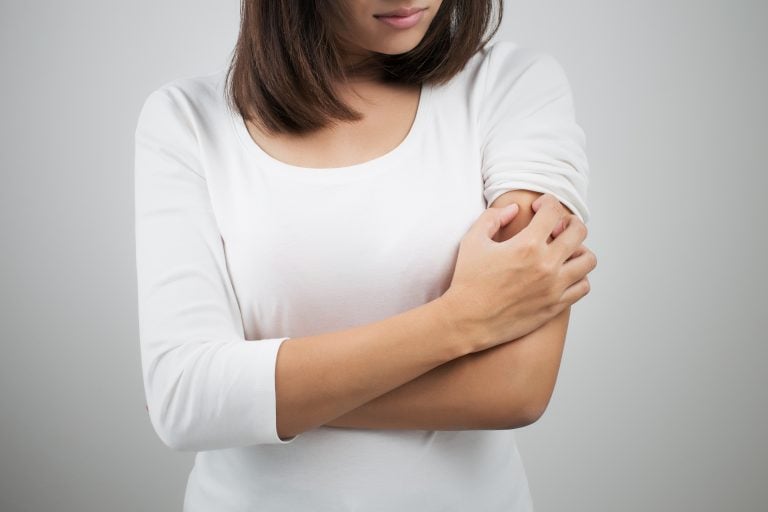 woman scratches upper arm