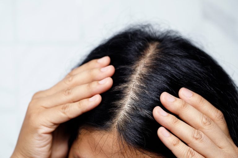 girl parts black hair to show scalp