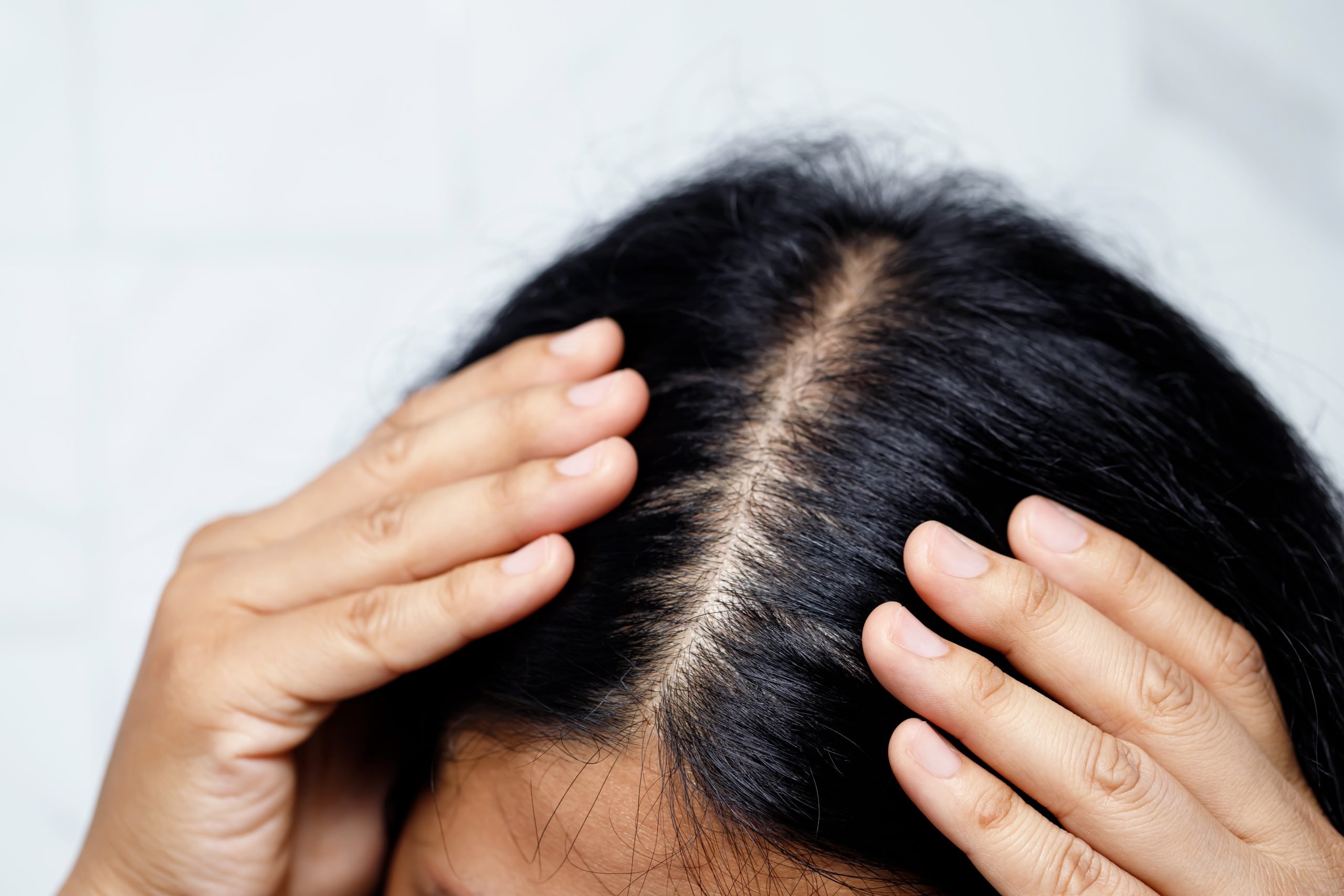 girl parts black hair to show scalp