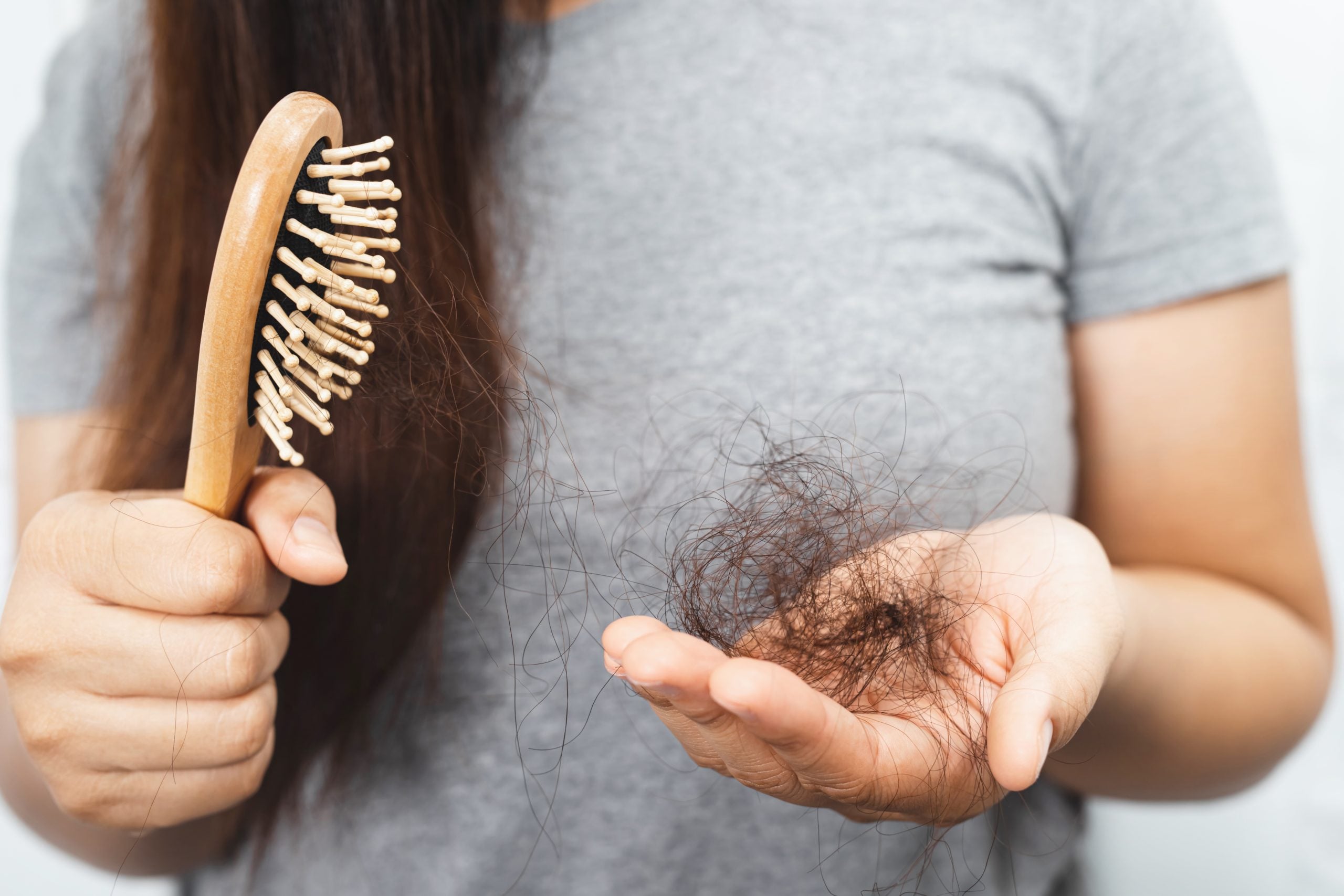 woman holds brush and small clump of lost hair in hands
